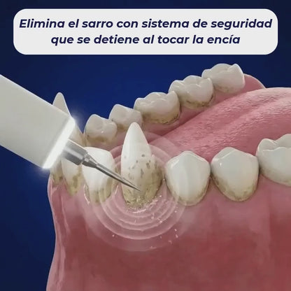 ViresClean™ - Elimina el sarro endurecido de tu perro desde casa
